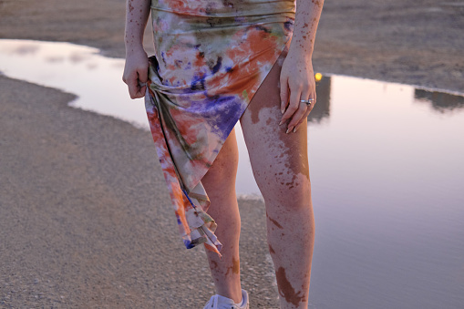 detail shoot of a millennial woman who is wearing a dress