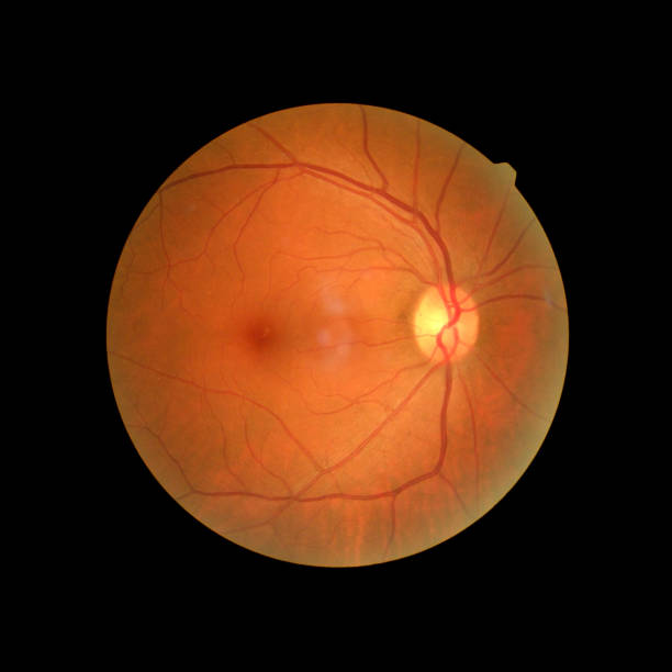 istock Photo Madical Retina Normal isolated on black background. 1419765871