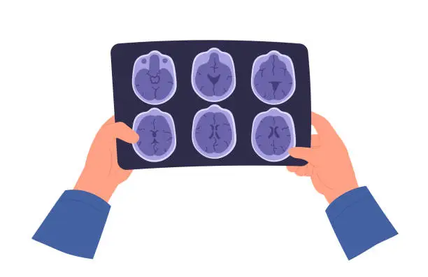 Vector illustration of Brain MRI scan. Magnetic resonance imaging. Hand holding image. Flat vector illustration.