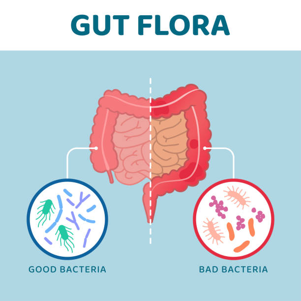 Good and bad gut bacteria Good and bad gut bacteria: comparison between healthy intestine and unhealthy intestine intestinal tract infection stock illustrations