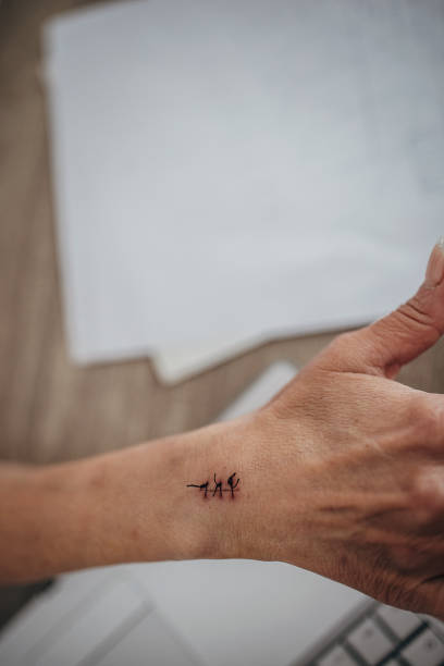 istock Female hand with stitches 1420177213
