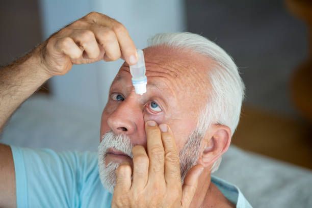 시력 문제를 해결하는 그의 눈에 액체 방울을 넣는 사람. 노인 드롭 안약 약을 떨어 뜨리고 눈의 통증을 치유합니다. 시력 및 안과 의학, 점안액을 적용하는 시니어 회색 머리 남자. - pain human eye senior adult men 뉴스 사진 이미지