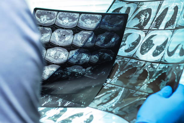 istock Doctor in mask examines and compares two MRI scans 1420423681