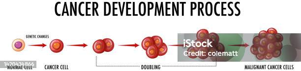 Cancer Development Process Infographic Stock Illustration - Download ...