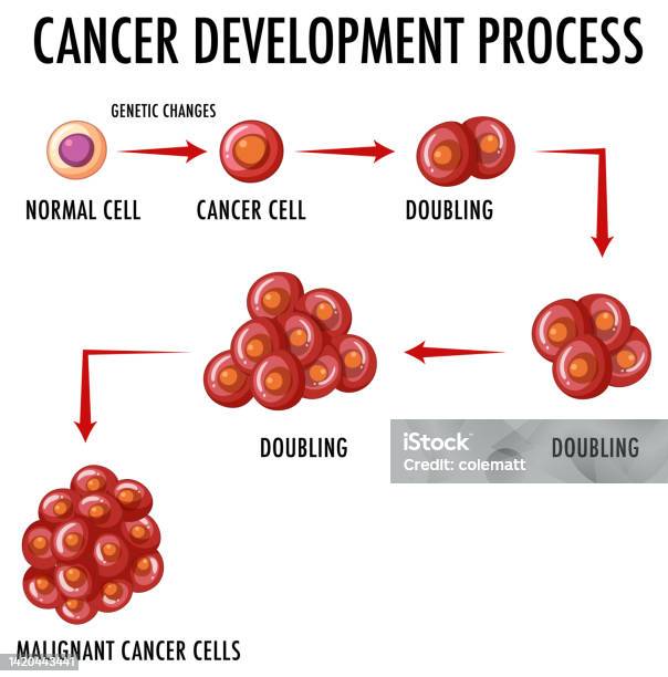 Cancer Development Published Cancer Development Process Infographic Stock Illustration - Download ...