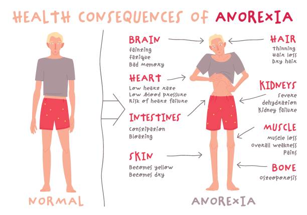ilustraciones, imágenes clip art, dibujos animados e iconos de stock de trastorno alimentario en hombres y niños. anorexia nerviosa. - repercussions