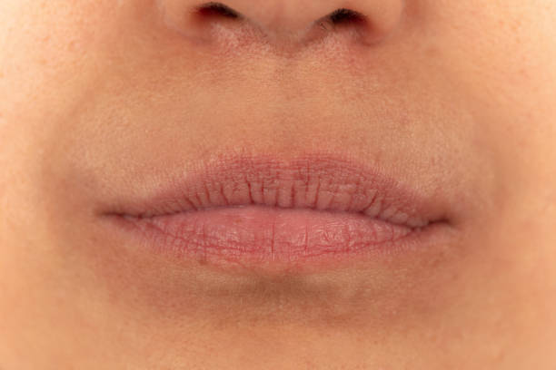 istock Close-up of female lips on white background before lip augmentation. 1420550826