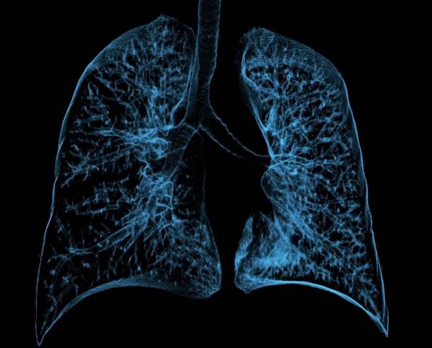 istock Healthy human lungs, 3D, axial  CT scan 1420638637