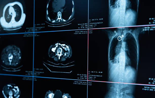 istock Human X-ray and tomographic images 1420646092