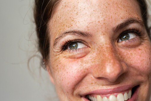 Close up portrait of beautyful fleckles woman