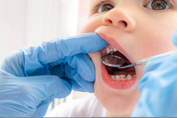 Closeup open mouth child and mirror in dentists hands in blue gloves checkup examine treating teeth to child, health care, children dental hygiene. stock photo