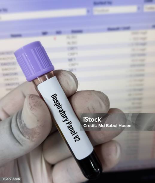 Labgen Respiratory Panel Blood Sample For Respiratory Panel V2 Test Stock Photo - Download Image ...