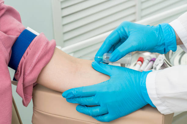 dłonie pielęgniarki w rękawiczkach przygotowują prawą rękę pacjenta do pobierania krwi. - sample zdjęcia i obrazy z banku zdjęć