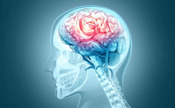 Human brain injury,damage,hemorrhage. 3d illustration stock photo