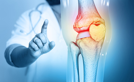El médico revisa y diagnostica el dolor en la articulación de la rodilla en los antecedentes médicos. Ilustración 3D photo