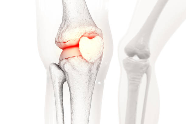 istock Pain in knee joint. Tendon problems and Joint inflammation. 3d illustration 1421002913