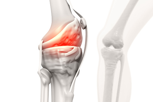 Pain in knee joint. Tendon problems and Joint inflammation. 3d illustration