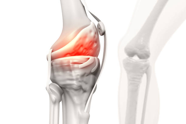 pain in knee joint. tendon problems and joint inflammation. 3d illustration - 3148 imagens e fotografias de stock
