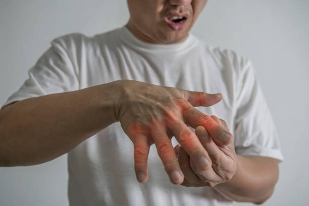 man hand suffering from joint pain with gout in finger. cause of pain include rheumatoid arthritis, carpal tunnel syndrome, trigger finger or gout. health care and medical concept. - finger on the trigger imagens e fotografias de stock