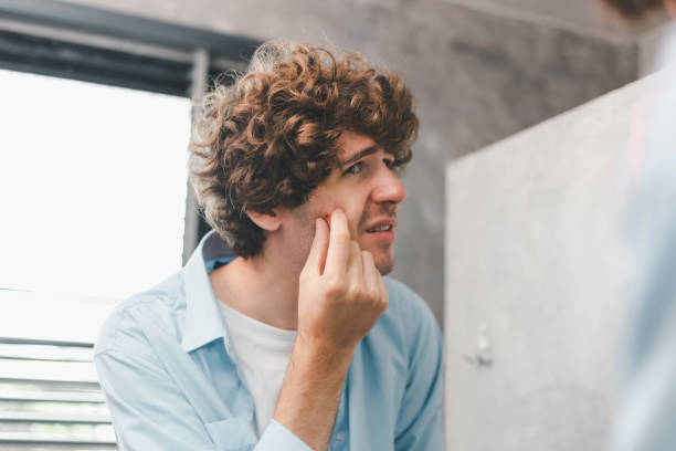 retrato do jovem caucasiano usando a mão apertou acne inflamatória dolorosa na bochecha com. conceito de beleza skincare. homem bonito olhando para si mesmo no espelho do banheiro apertando espinhas. - mirror men teenager depression - fotografias e filmes do acervo