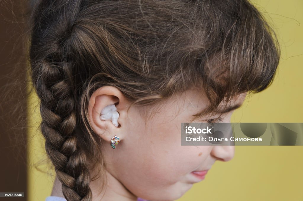 Girl with a warming therapeutic cotton swab in the ear with a sad and tearful face is holding her ear. Ear pain, otitis media, swelling of cheek, gums, toothache, children's surgery, otolaryngology 4-5 Years Stock Photo