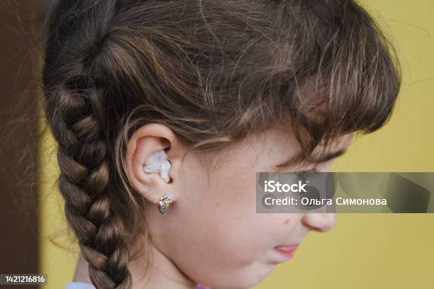 Girl With A Warming Therapeutic Cotton Swab In The Ear With A Sad And Tearful Face Is Holding Her Ear Ear Pain Otitis Media Swelling Of Cheek Gums Toothache Childrens Surgery Otolaryngology Stock Photo - Download Image Now