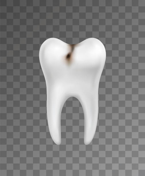 Rotting Teeth Texture 30+ Black Rotten Teeth Background Illustrations, Royalty-Free Vector ...