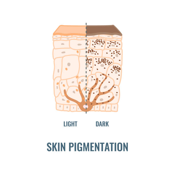 Human skin tone pigmentation diversity infographic diagram Melanin content and distribution in different skin phototypes. Pigmentation mechanism in dark and light skin. Epidermis cross-section infographic medical diagram. Vector illustration. pale complexion stock illustrations