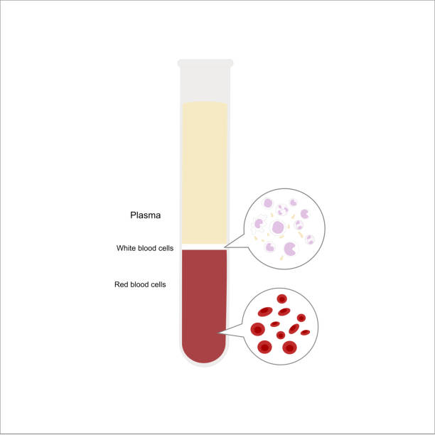 illustrations, cliparts, dessins animés et icônes de l’échantillon de sang périphérique ou total dans le tube à essai a été séparé en 3 couches: plasma, globules blancs (leucocytes) et globules rouges (érythrocytes) - serology