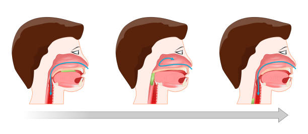 połykaniu. proces deglutynacji. - dysphagia stock illustrations