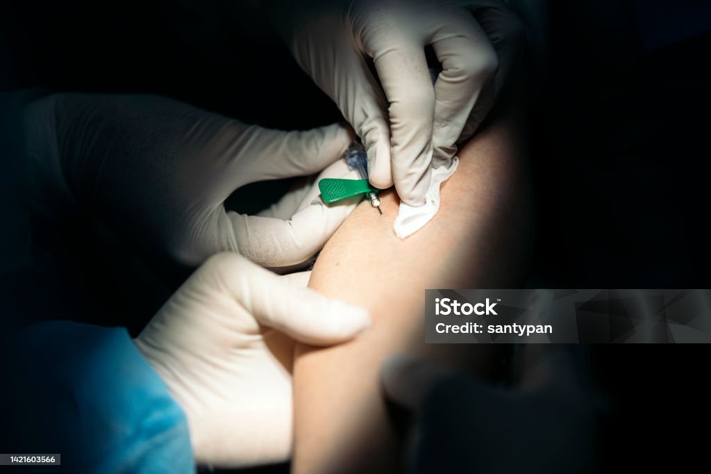 Using Needle Using Needle Close Up Stock Photo - Download Image Now - Acupuncture ...
