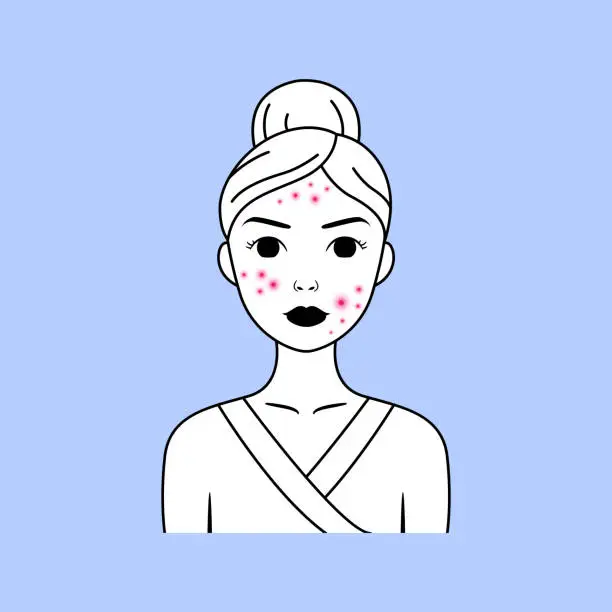 Vector illustration of Young Woman with Pimples on her Face. Acne. Portrait of a Lady with Problematic Skin. Ugly. Cartoon Line style. Black and White and Pink Color. Vector illustration for Beauty and Medical Design.