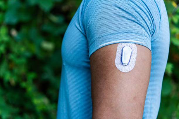 Athlete with Continuous Glucose Monitor Transmitter stock photo