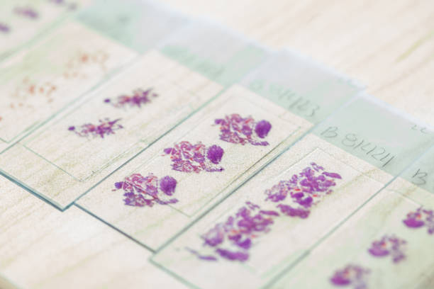 Stained tissue biopsy on glass slides in pathology laboratory