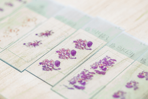 Stained tissue biopsy on glass slides in pathology laboratory