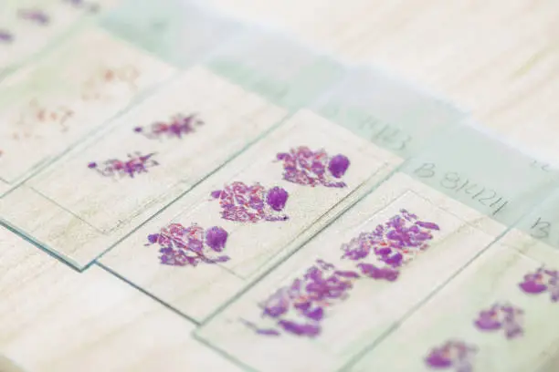 Photo of Stained tissue biopsy on glass slides in pathology laboratory