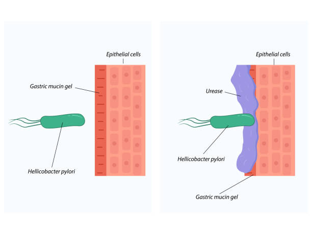 ilustraciones, imágenes clip art, dibujos animados e iconos de stock de invasión de helicobacter pylori en los tejidos del estómago - pylori