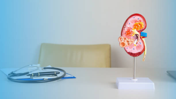 istock mockup kidney on work desk of doctor 1422471254