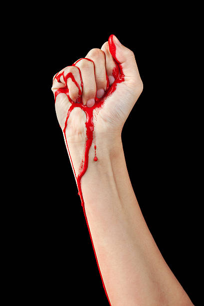 istock Bloody Fist 142303309