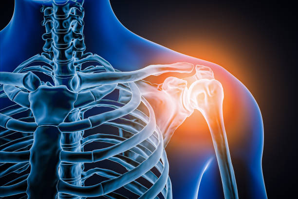 vista anterior o frontal de la articulación y los huesos del hombro humano con inflamación ilustración de representación 3d. patología, dolor articular, anatomía, osteología, reumatismo, concepto médico y sanitario. - shoulder fotografías e imágenes de stock