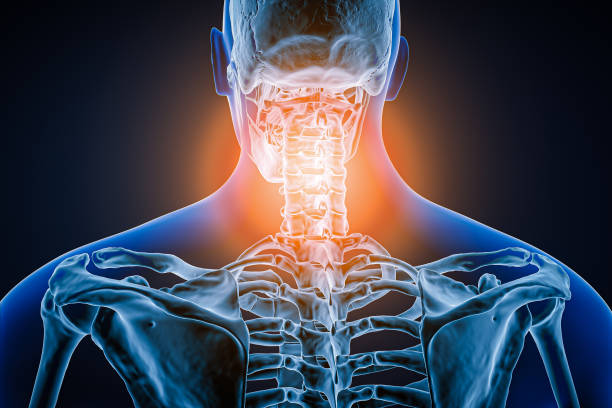 vue postérieure ou arrière de la colonne vertébrale humaine ou de la colonne vertébrale avec inflammation ou blessure illustration de rendu 3d. pathologie, douleur à la colonne vertébrale, anatomie, hernie cervicale, concept médical et de soins de s - back rear view backache posture photos et images de collection