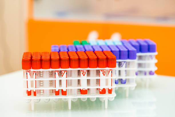 istock Empty test tube for blood. Chemistry laboratory experiment samples. 1423111462