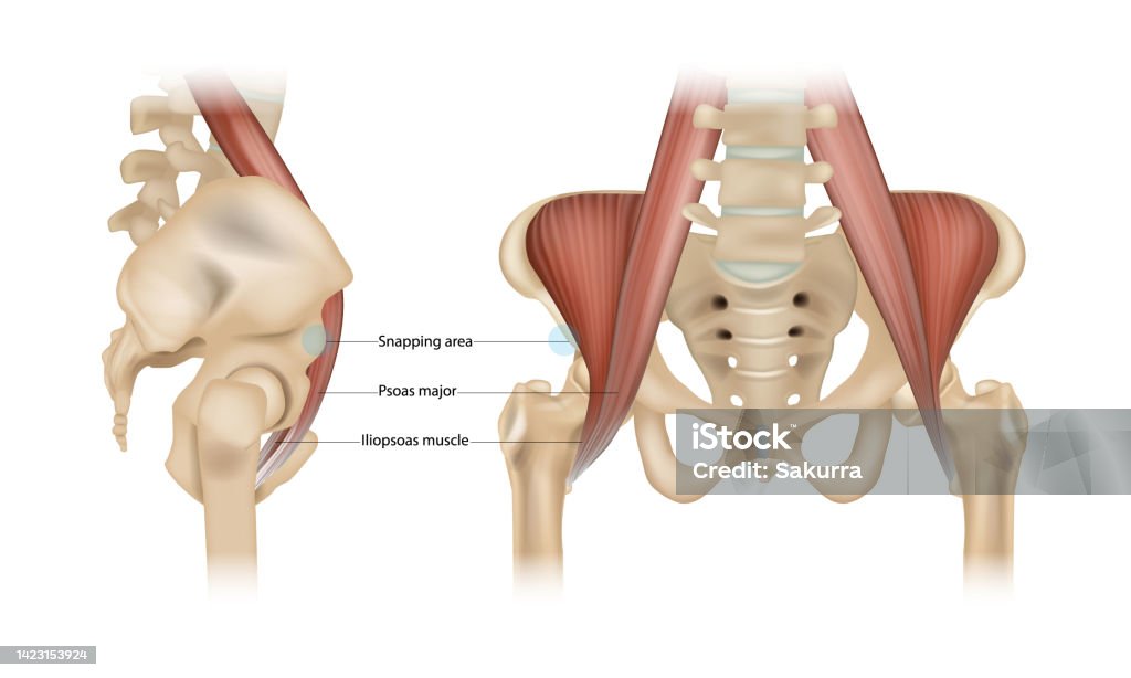 Síndrome de cadera de chasquido interno. Psoas mayor, músculo Iliopsoas y área de chasquido - arte vectorial de Músculo iliopsoas libre de derechos Síndrome de cadera de chasquido interno. Psoas mayor, músculo Iliopsoas y área de chasquido - arte vectorial de Músculo iliopsoas libre de derechos