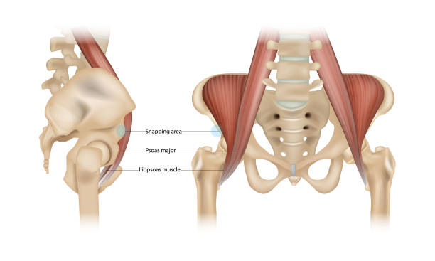 wewnętrzny zespół trzaskania biodra. psoas major, mięsień biodrowy i obszar snappingu - biodro stock illustrations