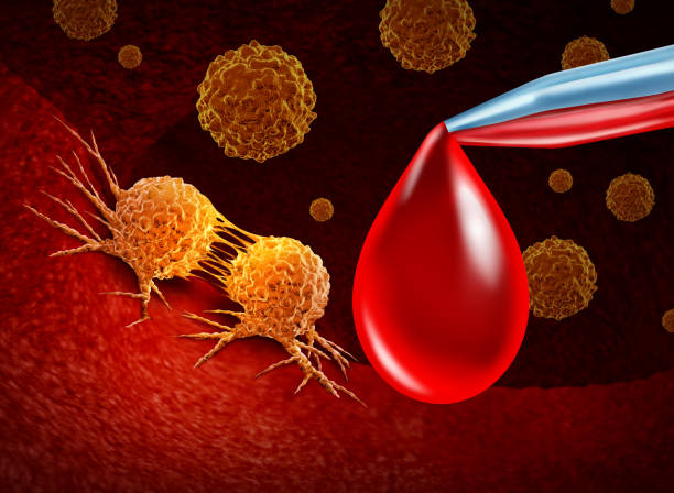 istock Cancer Screening Blood Test 1423172884