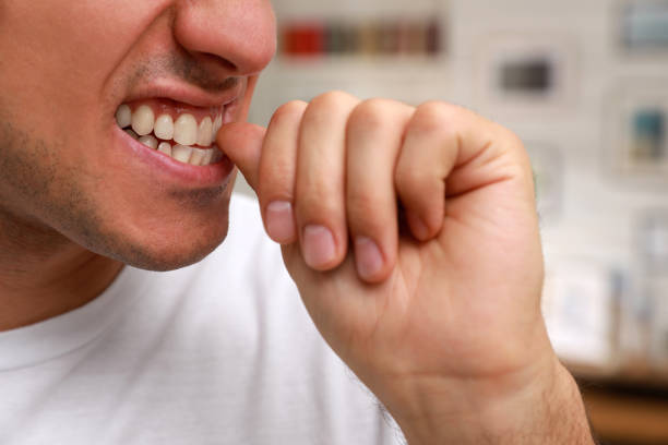 istock Man biting his nails indoors, closeup. Bad habit 1423390936