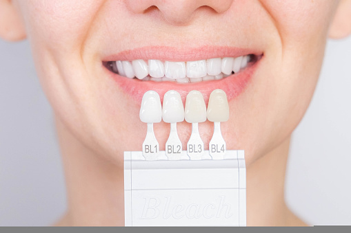 Perfect white smile with shade guide bleach color tooth dental whitening, bleaching, quality control and color check at artificial dentition, female veneer smile, dental care and stomatology