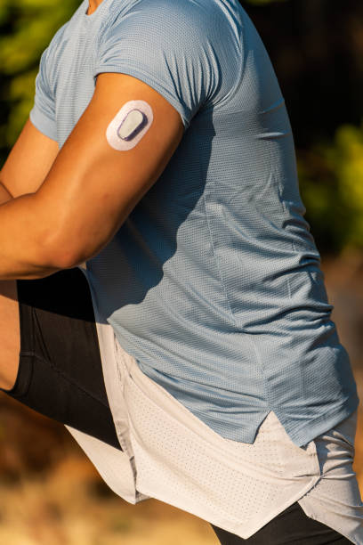 istock Athlete Stretching with Continuous Glucose Monitor Transmitter 1423457005
