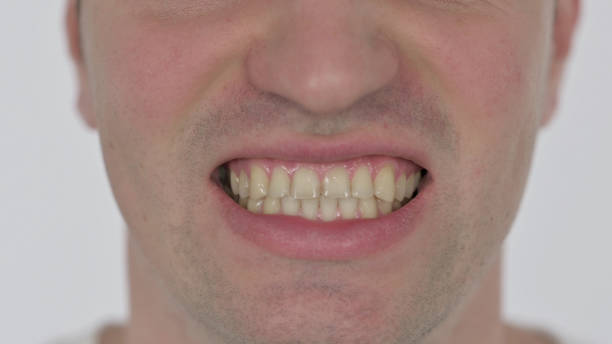istock Close up of Angry Young Man Crunching Teeth 1423464562