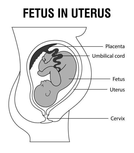 Fetus in Uterus Fetus in Uterus During Pregnancy. Placental Locations.  Pathology. 
Detailed Medical vector illustration. abdominal cavity stock illustrations